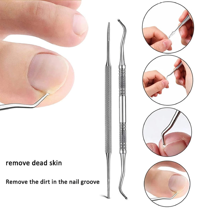 Professional Ingrown Toenail Treatment Set with Correction Patches and Pedicure Tools