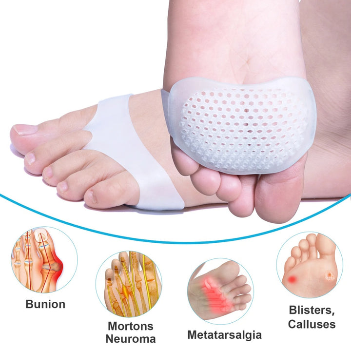 White Silicone Forefoot Pads