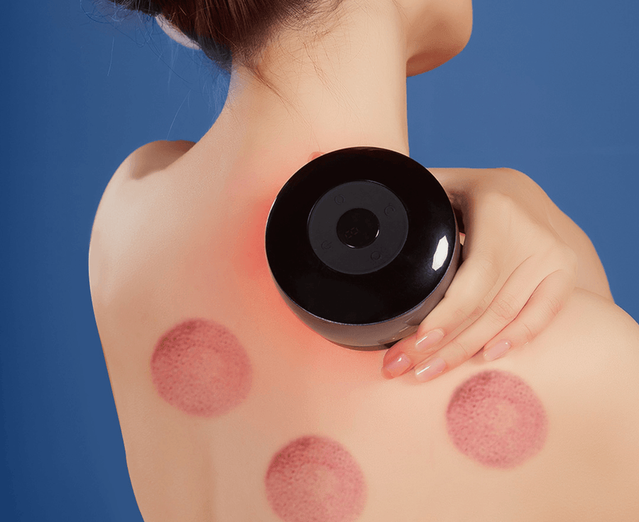 Zdeer Electric Cupping Scraping Device Smart Mini Infrared Physiotherapy Magnetic Resonance Machine from XIAOMI Youpin - Trendha