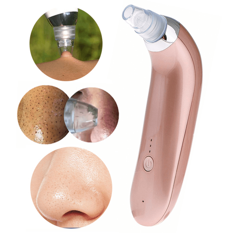 Y.F.M® Rechargeable Electric Blackhead Suction Acne Remover Vacuum Microdermabrasion Pore Cleanser Facial Skin - Trendha